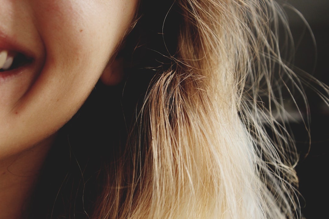 Restoring Your Smile: Before and After Partial Dentures